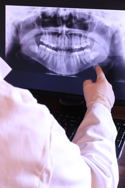 Best Emergency Denture Repair in Short Pump, VA